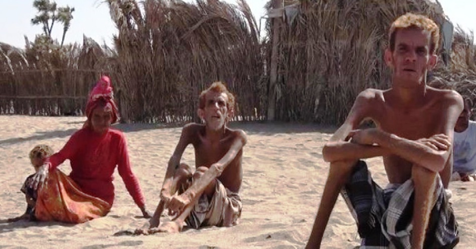 الأمم المتحدة: إنعدام الأمن الغذائي في اليمن أسوأ مجاعة من صنع الإنسان شهدها العالم الأمم المتحدة: إنعدام الأمن الغذائي في اليمن أسوأ مجاعة من صنع الإنسان شهدها العالم