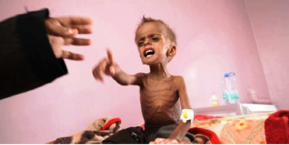 الأمم المتحدة: إنعدام الأمن الغذائي في اليمن أسوأ مجاعة من صنع الإنسان شهدها العالم الأمم المتحدة: إنعدام الأمن الغذائي في اليمن أسوأ مجاعة من صنع الإنسان شهدها العالم