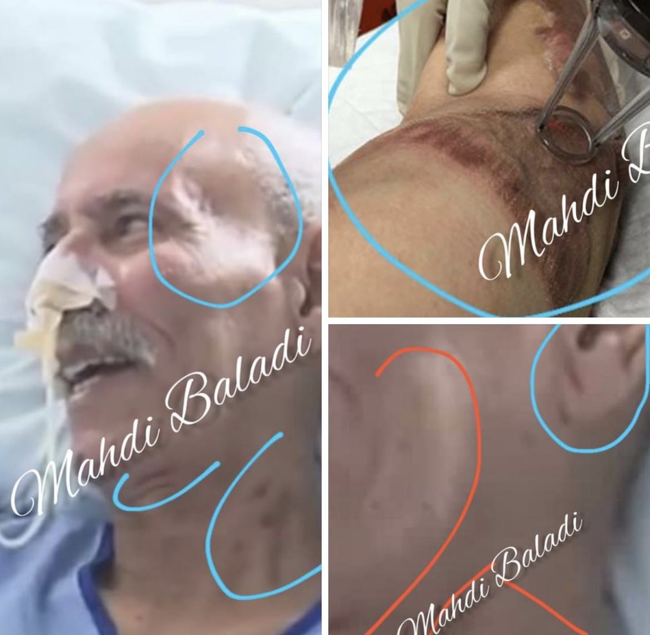 زعيم مرتزقة البوليساريو لم يصب بكورونا وهذا هو السبب الحقيقي وراء علاجه في إسبانيا زعيم مرتزقة البوليساريو لم يصب بكورونا وهذا هو السبب الحقيقي وراء علاجه في إسبانيا