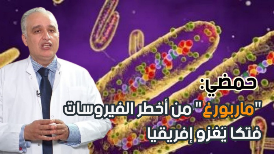 "ماربورغ".. الفيروس الأسرع انتشارا والأشد فتكا يدق أبواب المغرب "ماربورغ".. الفيروس الأسرع انتشارا والأشد فتكا يدق أبواب المغرب