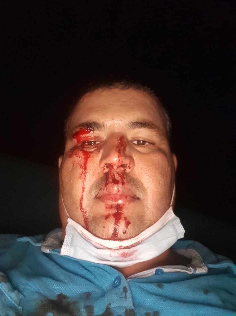 بالصور والفيديو.. بلطجية واعتداءات في حملات انتخابية دون حسيب أو رقيب بـ"أفورار"!!! بالصور والفيديو.. بلطجية واعتداءات في حملات انتخابية دون حسيب أو رقيب بـ"أفورار"!!!