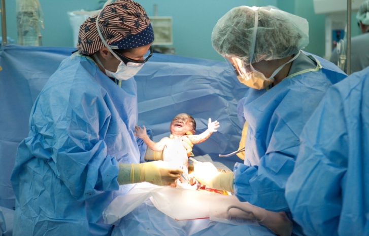 عملية قيصرية بدون تخدير تودي بحياة جنين عملية قيصرية بدون تخدير تودي بحياة جنين