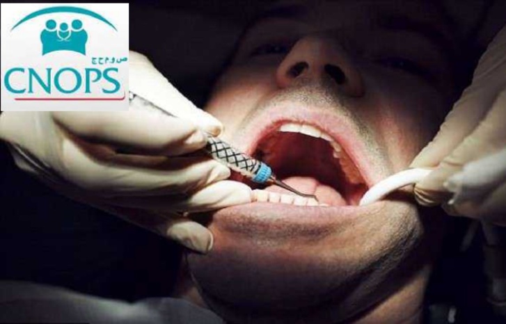 ارتفاع تكلفة علاجات طب الأسنان تقصم ظهر "الكنوبس" والمواطن ارتفاع تكلفة علاجات طب الأسنان تقصم ظهر "الكنوبس" والمواطن
