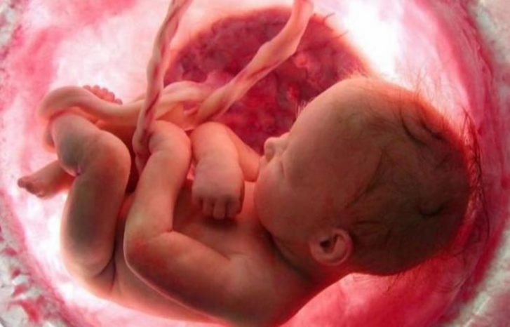 تحذير للنساء الحوامل.. لا يرحم حتى الأجنة الذين لم يروا الحياة بعد.. تحذير للنساء الحوامل.. لا يرحم حتى الأجنة الذين لم يروا الحياة بعد..
