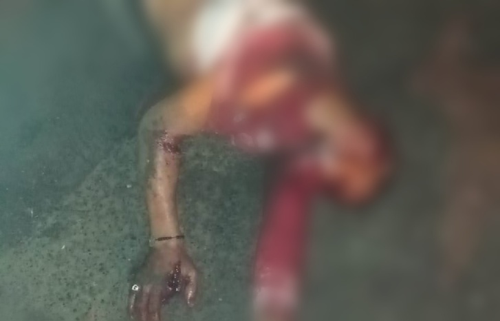 بالصور.. جريمة اعتداء مروعة بسكين كبير وكلب شرس اهتز لها الرأي العام بالصور.. جريمة اعتداء مروعة بسكين كبير وكلب شرس اهتز لها الرأي العام