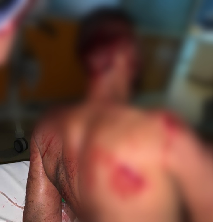 بالصور.. جريمة اعتداء مروعة بسكين كبير وكلب شرس اهتز لها الرأي العام بالصور.. جريمة اعتداء مروعة بسكين كبير وكلب شرس اهتز لها الرأي العام