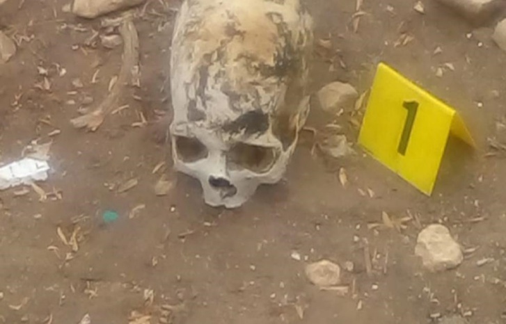 استنفار أمني بسبب تجول مختل بجمجمة بشرية ضواحي بني ملال استنفار أمني بسبب تجول مختل بجمجمة بشرية ضواحي بني ملال