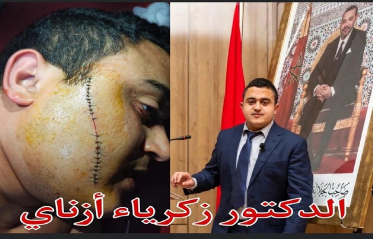 وجدة.. اعتداء شنيع على طالب باحث داخل الحرم الجامعي وجدة.. اعتداء شنيع على طالب باحث داخل الحرم الجامعي