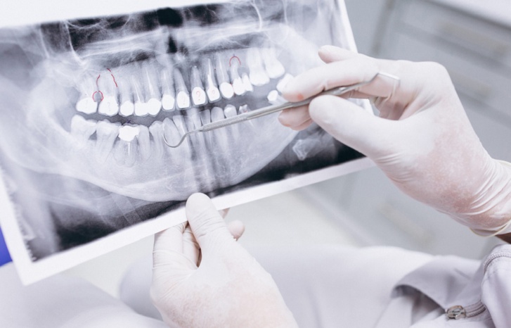 سلا.. توقيف شبكة إجرامية تنشط في طب وجراحة الأسنان بدون ترخيص سلا.. توقيف شبكة إجرامية تنشط في طب وجراحة الأسنان بدون ترخيص