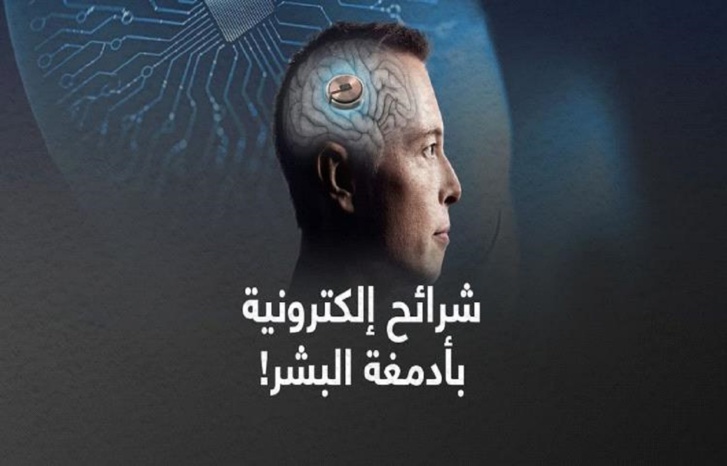 الولايات المتحدة توافق على زرع شرائح ذكية في أدمغة البشر الولايات المتحدة توافق على زرع شرائح ذكية في أدمغة البشر