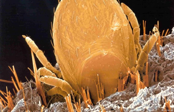 "ألونجشان".. انتشار فيروس جديد في أوروبا "ألونجشان".. انتشار فيروس جديد في أوروبا