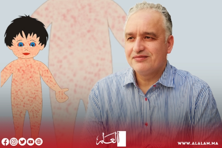 حمضي يكشف عن الوضع الخطير لحالات الحصبة وضرورة التلقيح حمضي يكشف عن الوضع الخطير لحالات الحصبة وضرورة التلقيح