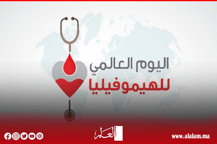وزارة الصحة تخلّد اليوم العالمي للهيموفيليا وتطلق حملة تحسيسية وطنية لمكافحة هذا المرض وزارة الصحة تخلّد اليوم العالمي للهيموفيليا وتطلق حملة تحسيسية وطنية لمكافحة هذا المرض