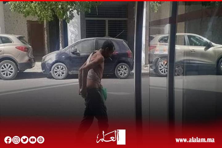 أنقذوا بني ملال من فوضى المختلين عقلياً.. كرامة الإنسان وأمن المواطن خط أحمر! أنقذوا بني ملال من فوضى المختلين عقلياً.. كرامة الإنسان وأمن المواطن خط أحمر!