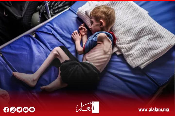 مسؤول أممي يحذر من "تداعيات كارثية" لتوسيع العمليات العسكرية الإسرائيلية في غزة مسؤول أممي يحذر من "تداعيات كارثية" لتوسيع العمليات العسكرية الإسرائيلية في غزة