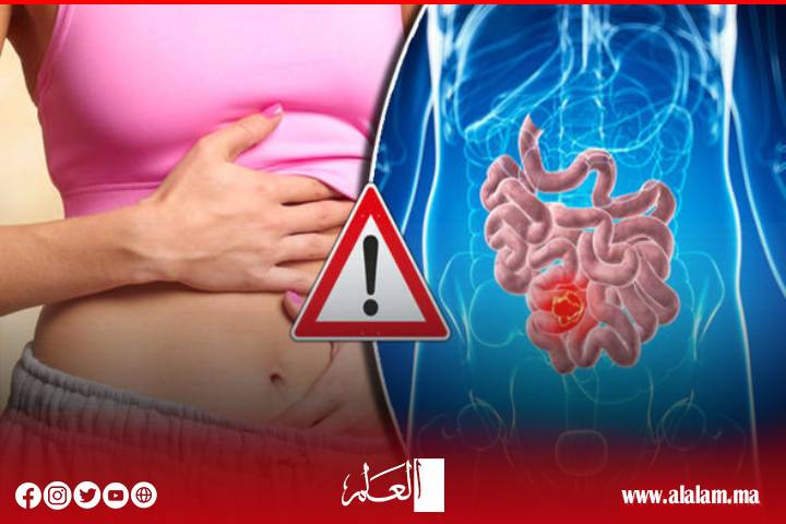 Constipation ... une maladie silencieuse qui menace le système digestif et le cœur