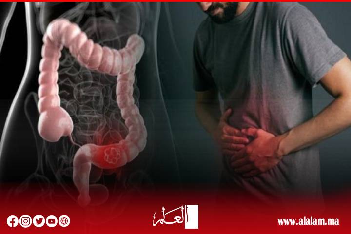 Constipation ... une maladie silencieuse qui menace le système digestif et le cœur