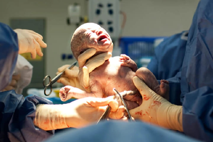 وفاة سيدة حامل وجنينها بطاطا تعيد ملف الصحة إلى الواجهة