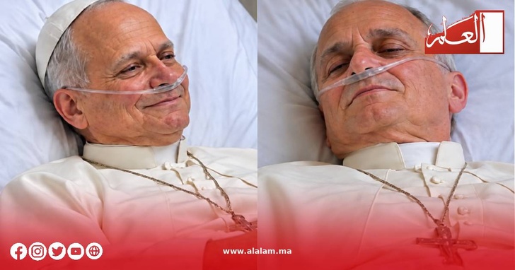 البابا ليون الرابع عشر يواصل التعافي بعد جراحة الرئة البابا ليون الرابع عشر يواصل التعافي بعد جراحة الرئة