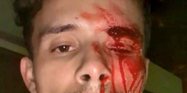 الوزير السابق لحسن الداودي يرد بعد اعتقال ابنته نادية الوزير السابق لحسن الداودي يرد بعد اعتقال ابنته نادية