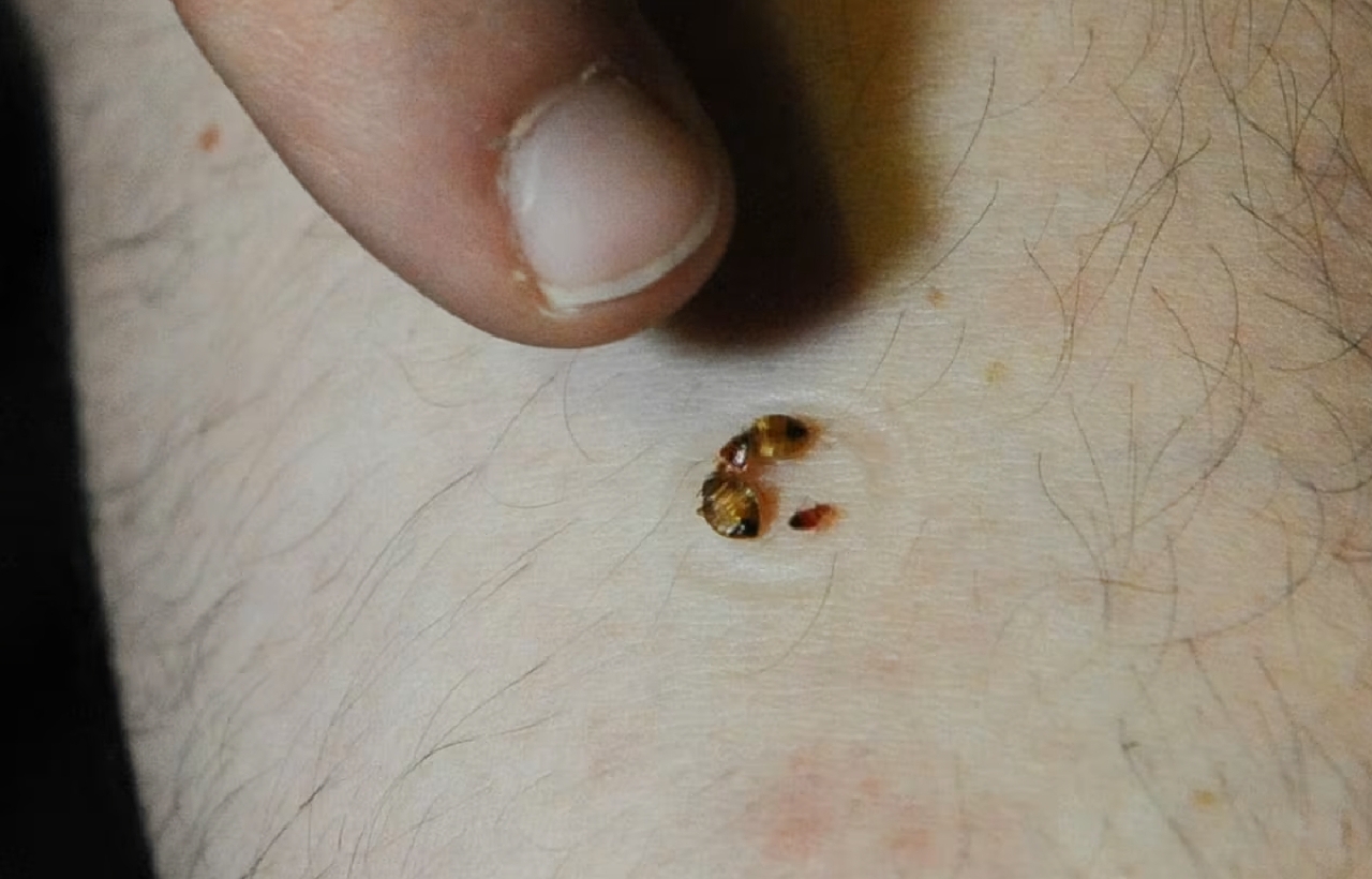 حشرات ماصة للدماء تجتاح باريس وتهدد العالم حشرات ماصة للدماء تجتاح باريس وتهدد العالم