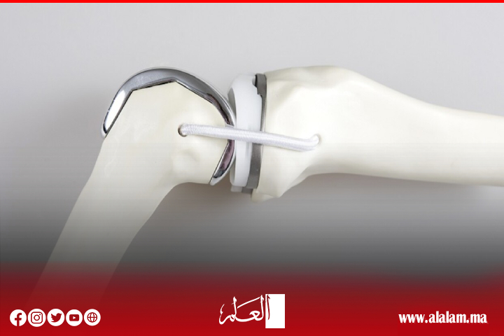 أسرع وبتكاليف أقل.. تطوير طريقة جديدة لإنتاج المفاصل الاصطناعية أسرع وبتكاليف أقل.. تطوير طريقة جديدة لإنتاج المفاصل الاصطناعية