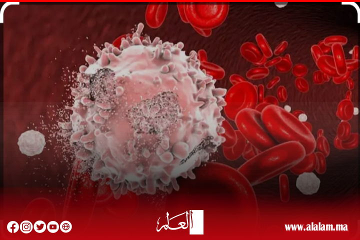 سبتمبر شهر التوعية بسرطان الدم: أعراضه وأنواعه وعوامل خطر الإصابة به سبتمبر شهر التوعية بسرطان الدم: أعراضه وأنواعه وعوامل خطر الإصابة به