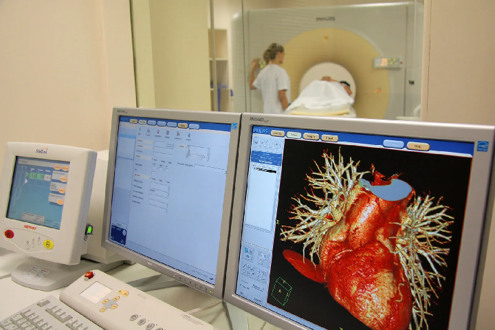 إعادة تأهيل مرضى القلب: استعادة السيطرة على الصحة بعد حادث قلبي إعادة تأهيل مرضى القلب: استعادة السيطرة على الصحة بعد حادث قلبي