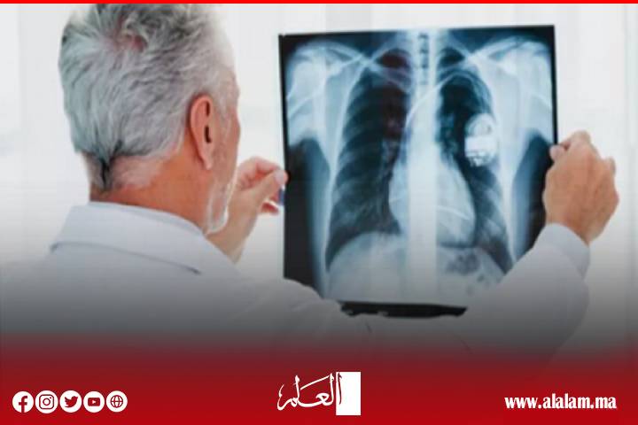 المغرب يُخَلد اليوم العالمي لمحاربة داء السل المغرب يُخَلد اليوم العالمي لمحاربة داء السل