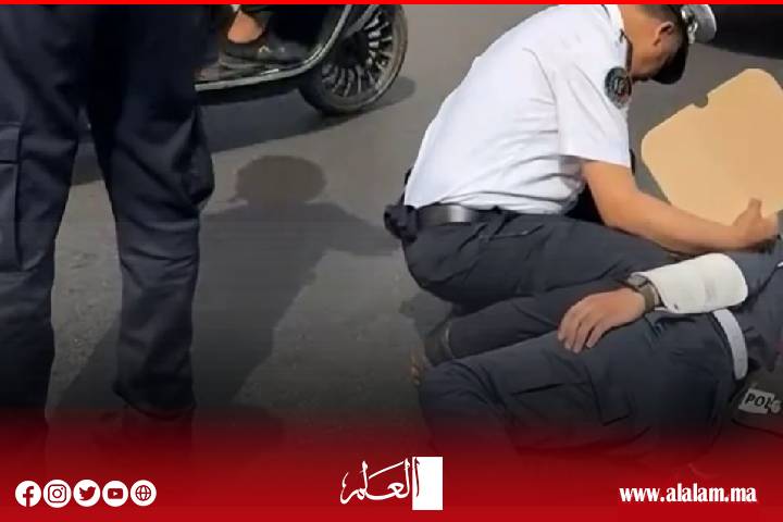 ترقية استثنائية لشرطي تعرض لحادث خطير أثناء مزاولته عمله