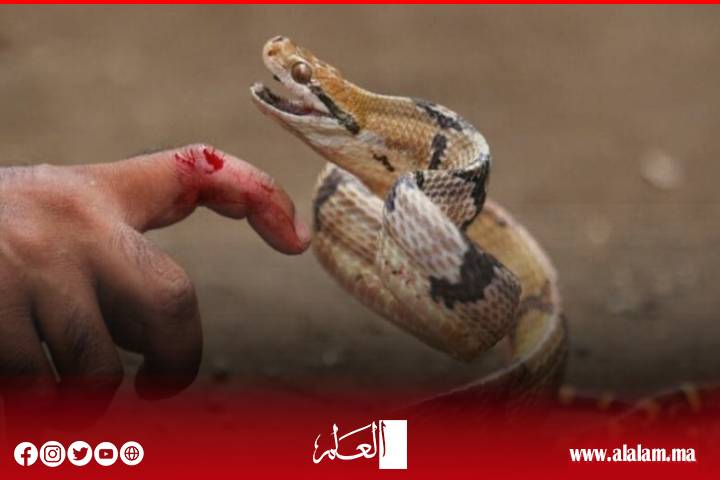 لدغة أفعى تُرسل شابًا من دوار إعشيران إلى قسم الإنعاش