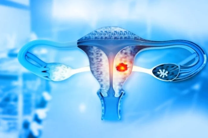 تراجع مستمر في معدلات الإصابة بسرطان عنق الرحم ببلادنا