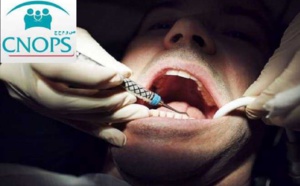 ارتفاع تكلفة علاجات طب الأسنان تقصم ظهر "الكنوبس" والمواطن