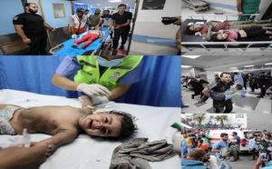 منظمة الصحة العالمية تُعْلِنْ بدء عمليات بتر الأطراف دون تخدير في غزة