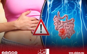 الإمساك… داء صامت يُهدد الجهاز الهضمي والقلب