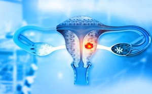 تراجع مستمر في معدلات الإصابة بسرطان عنق الرحم ببلادنا