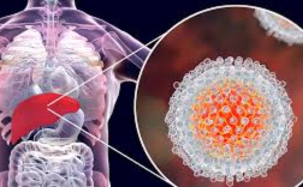أولى‭ ‬الخطوات‭ ‬تنطلق‭ ‬في‭ ‬سباق‭ ‬طويل‭ ‬لمحاربة‭ ‬التهاب‭ ‬الكبد‭ ‬الوبائي‭ ‬بالمغرب