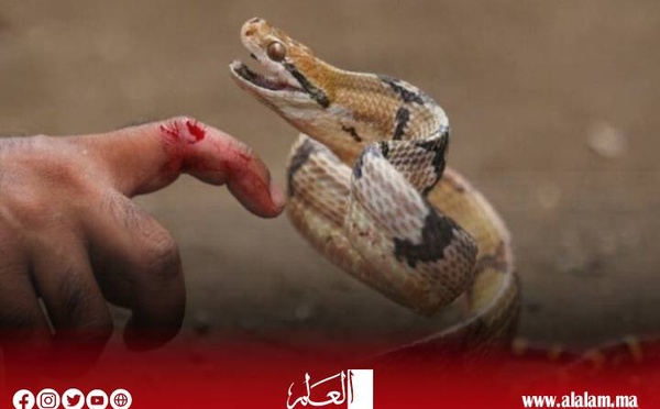 لدغة أفعى تُرسل شابًا من دوار إعشيران إلى قسم الإنعاش