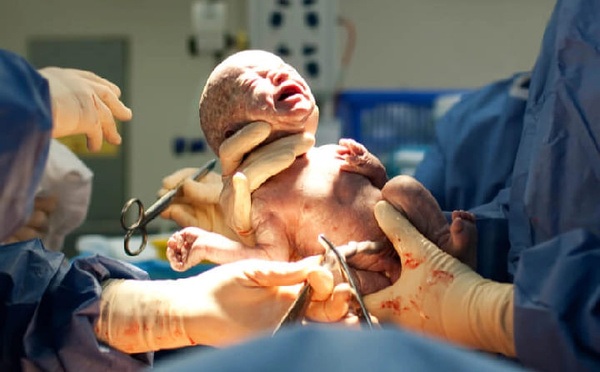 وفاة سيدة حامل وجنينها بطاطا تعيد ملف الصحة إلى الواجهة