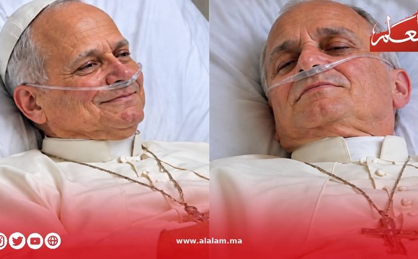 سرطان الرئة يدخل البابا ليون غرفة العمليات… والفاتيكان يكشف مستجدات التعافي