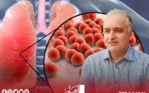 داء السل في المغرب.. التحديات والحلول المقترحة