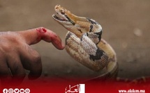 لدغة أفعى تُرسل شابًا من دوار إعشيران إلى قسم الإنعاش