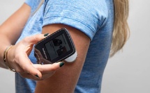 أجهزة قياس السكري المستمر بين الحياة والألم