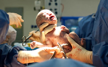 وفاة سيدة حامل وجنينها بطاطا تعيد ملف الصحة إلى الواجهة